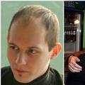 Павел Дуров — фотографии программиста после пластики и наращивания волос